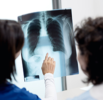 lungsxray
